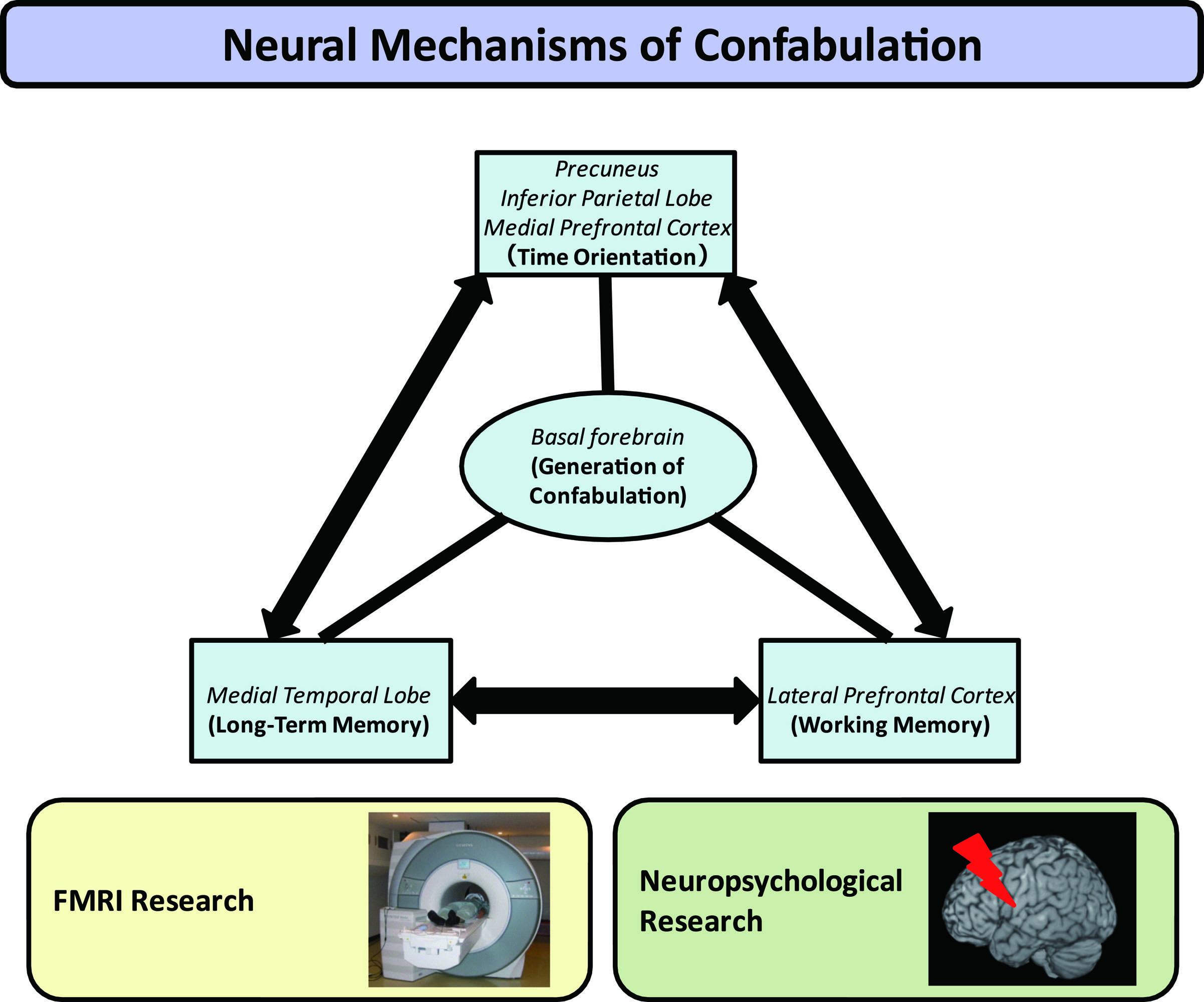 Neural mechanisms of confabulation: Interaction between time orientation and memory